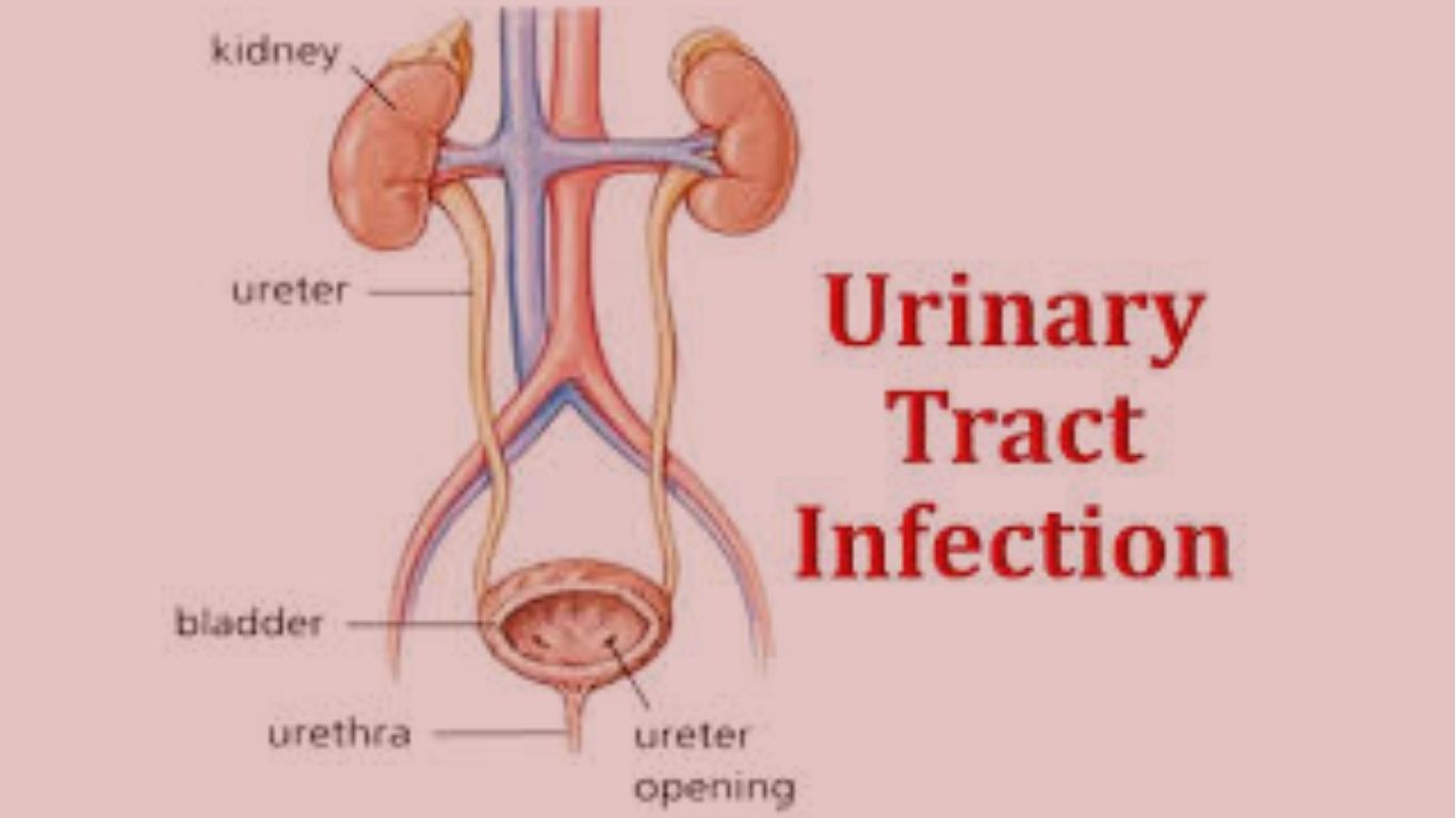 inary tract