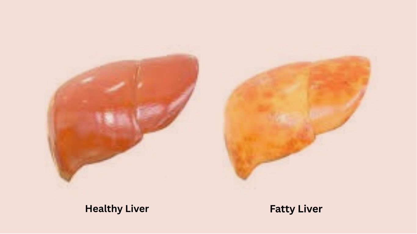 Healthy Liver