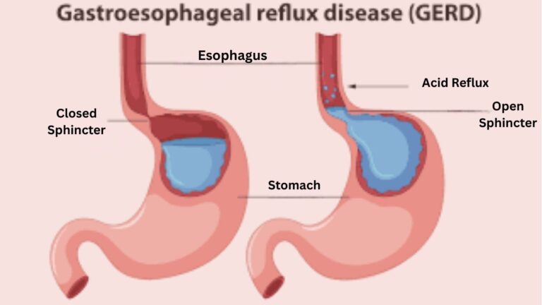 Esophagus