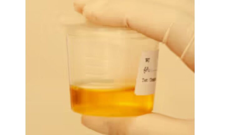 creatinine w
