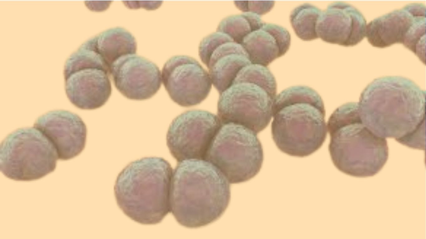 pneumo toxin w